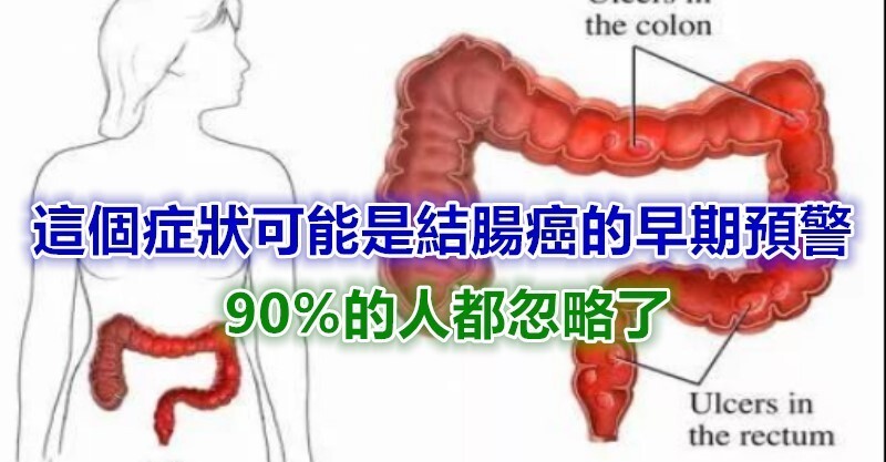 这个症状可能是「结肠癌」的早期预警